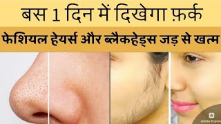 Viral Facial Hair Removal Cream 😯 glamgalaxy skincare rashmi facialhairremoval beauty trending [upl. by Artemed943]