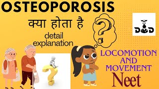 Osteoporosis disease detailed explanation neet [upl. by Sheffield]