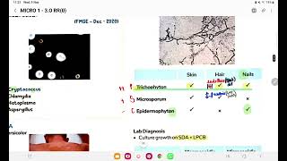 mycology microbiology rapid revisìon [upl. by Gapin515]