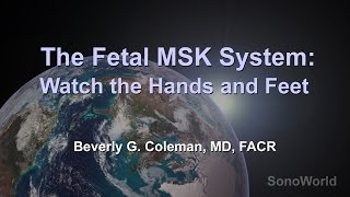 quotThe Fetal MSK System Watch the Hands and Feetquot Ultrasound SonoWorld Lecture [upl. by Nevins]