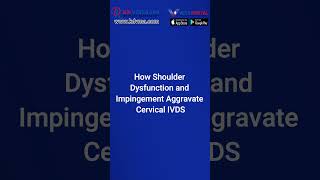 Serviceconnected shoulder impingement can cause cervical IVDS veteranassistance military viral [upl. by Munford554]