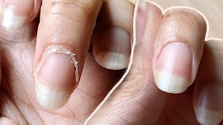 NAIL TRANSFORMATION  how I CUT CUTICLES at HOME  Basic Tools ONLY [upl. by Kcirevam]