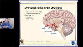 Relaxation and Counterconditioning Therapy for Misophonia Feb 2020 Webinar [upl. by Yrral]