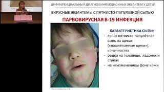 18022017  Дифференциальный диагноз экзантем у детей [upl. by Seyler]