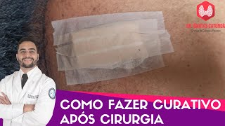 Como fazer curativo após uma cirurgia [upl. by Assylla]