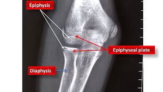 Age Estimation From Elbow Xray [upl. by Orfurd]