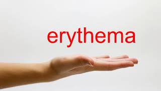 How to Pronounce erythema  American English [upl. by Dian]