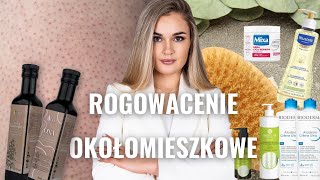 Czerwone krostki na ramionach udach pośladkach  Rogowacenie Okołomieszkowe  Keratosis Pilaris [upl. by Eilssel]