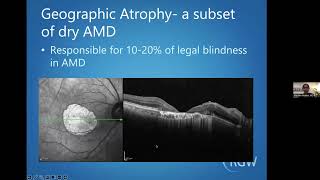 AgeRelated Macular Degeneration AMD 101 [upl. by Ayle]