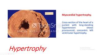 Cellular Response to Stress Adaptation Hypertrophy [upl. by Viva]