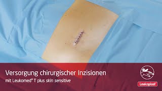 Leukoplast Leukomed T plus skin sensitive – Versorgung chirurgischer Inzisionen [upl. by Aicercal]