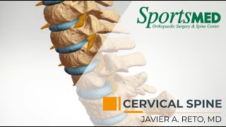 CERVICAL RADICULOPATHY Common Symptoms and Treatment Options  Dr Javier Reto [upl. by Erminna]