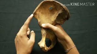 Osteology of Hip bone Real bone  Osteology  Discussion  Anatomy [upl. by Broucek812]