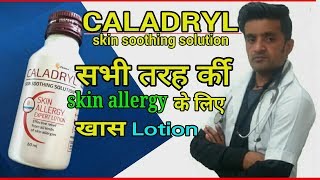 CALADRYL LOTION दाद खाज खुजली व सभी प्रकार की एलर्जी के लिए वेस्ट लोशन। [upl. by Kamillah]