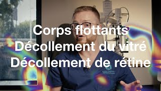 Corps flottants décollement du vitré déchirure et décollement de la rétine  COF [upl. by Barnebas]