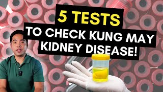 5 Tests Para Malaman Kung May Kidney Disease [upl. by Gorton38]