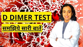 D Dimer Test Procedure in Hindi  What is D Dimer Test and How its Done [upl. by Fritz]