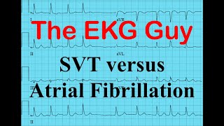 EKGECG  SVT vs Atrial Fibrillation  The EKG Guy  wwwEKGmd [upl. by Ruelu271]