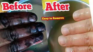 How to Remove Hair Dye from Hand amp Nail  घंटो का काम मिंटोमें डाइ को निकाले चुटकियों में 1 ट्रिक [upl. by Harrad]