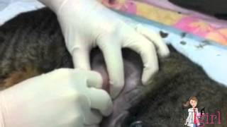 VG Abscess Video [upl. by Notsek]