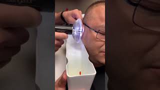 Amazing ear wax removal Eps 19 cheanskincare short ance earwaxremoval [upl. by Harpp629]