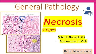 Necrosis  Pathology [upl. by Asnarepse603]