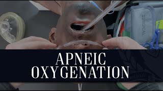 ApOx  Apneic Oxygenation [upl. by Bent]