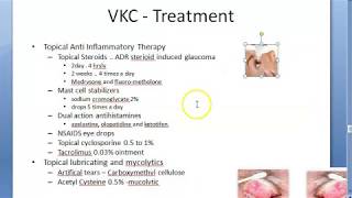 Ophthalmology 088 c Vernal KeratoConjunctivitis Spring Catarrh Treatment How [upl. by Aleirbag]