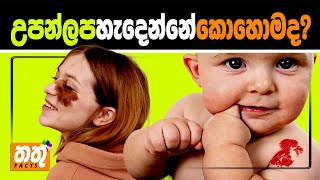 උපන් ලප ගැන අමුතු කතා  Why do we have Birthmarks  SINHALA infotainment Video  තතුFACTS [upl. by Noicpecnoc771]