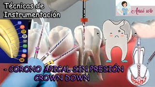 ENDODONCIA  Técnicas de Instrumentación Corono Apical o Crown Down  PARTE 2 [upl. by Adnahsar]