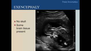 Ultrasound Training Course 17 part 1 [upl. by Virgie]