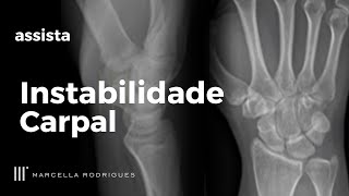 INSTABILIDADE CARPAL Aprenda a Diagnosticar e Tratar [upl. by Cave]