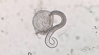 Parasitosis causada por Toxocara spp [upl. by Ailin]