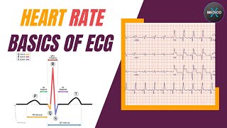 Heart rate ECG  ECG by Medico X Part3  ecg [upl. by Hendrik]