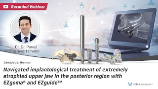 WebinarNavigated implantological treatment of extremely atrophied upper jaw in the posterior region [upl. by Warp]