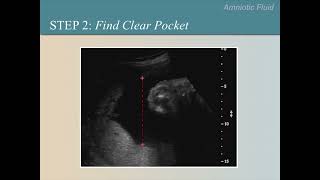 Ultrasound Training Course 10 part 1 [upl. by Iteerp]