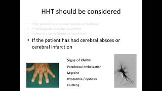 Hereditary Haemorrhagic Telangiectasia HHT for ENT doctors by Prof Anette Kjeldsen [upl. by Freemon814]