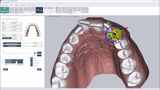 Direct printing of aligners  Deltaface orthodontic software [upl. by Glori]