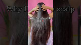 Itchy scalp shorts haircare hairgrowth [upl. by Lindley]