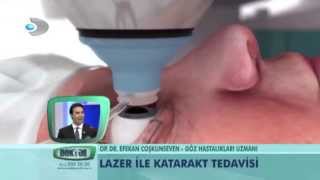 lazer katarakt ameliyati nedir [upl. by Colbert59]