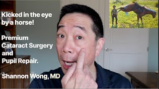 Kicked in the eye by a horse Pupil repair and premium cataract surgery Shannon Wong MD [upl. by Seldon]