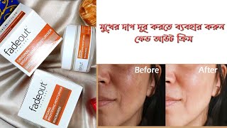 মুখের দাগ দূর করতে  Fade out cream  For men and women [upl. by Nilyarg]