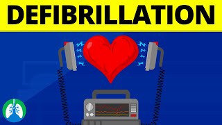 Defibrillation Medical Definition  Quick Explainer Video [upl. by Sillert931]