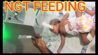 NGT FEEDING OF NEWBORN BABY IN NICU NeonatalCareindia [upl. by Dnallor]