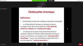 Gastro 25Complications de la lithiase vésiculaire LV [upl. by Lindi]