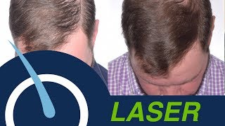 Laser Therapy LLLT  NonSurgical way to Grow your Hair [upl. by Bajaj]