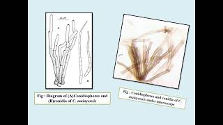 Cercospora leaf spot of okra prepared by Boyapati Ravi Teja Naidu and Rajat Kumar [upl. by Alil]