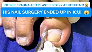 CHOOSE PROPER TREATMENT FOR THE BEST NAIL SURGERY WENT HORRIBLY WRONG 😭 [upl. by Anidene]