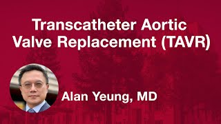 Transcatheter Aortic Valve Replacement TAVR [upl. by Gemoets]