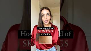 How to get rid of skin tags with pcos [upl. by Notled]